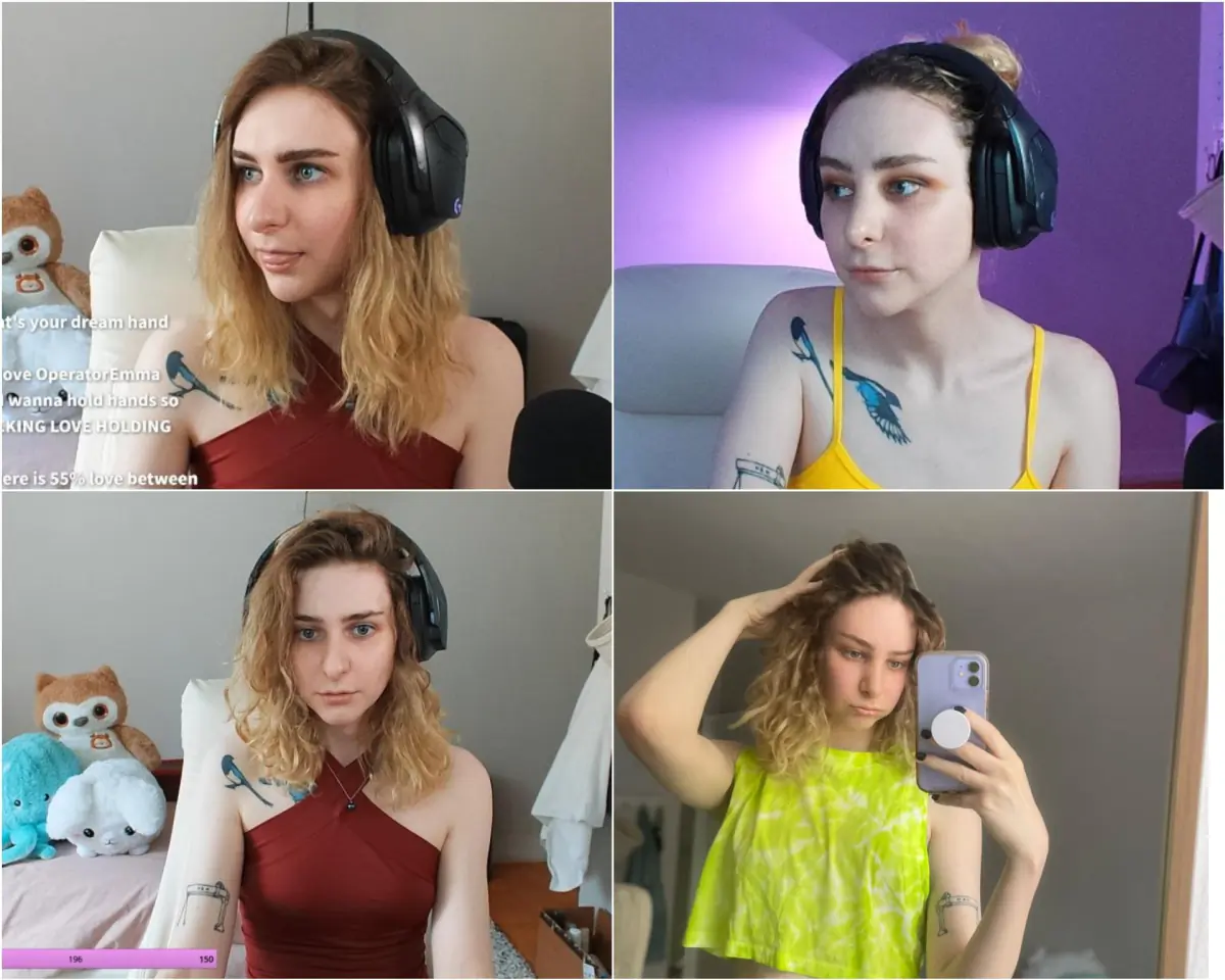 Pre vs Post FFS comparison (photos are just 1 month post op - forehead/nose/trac...