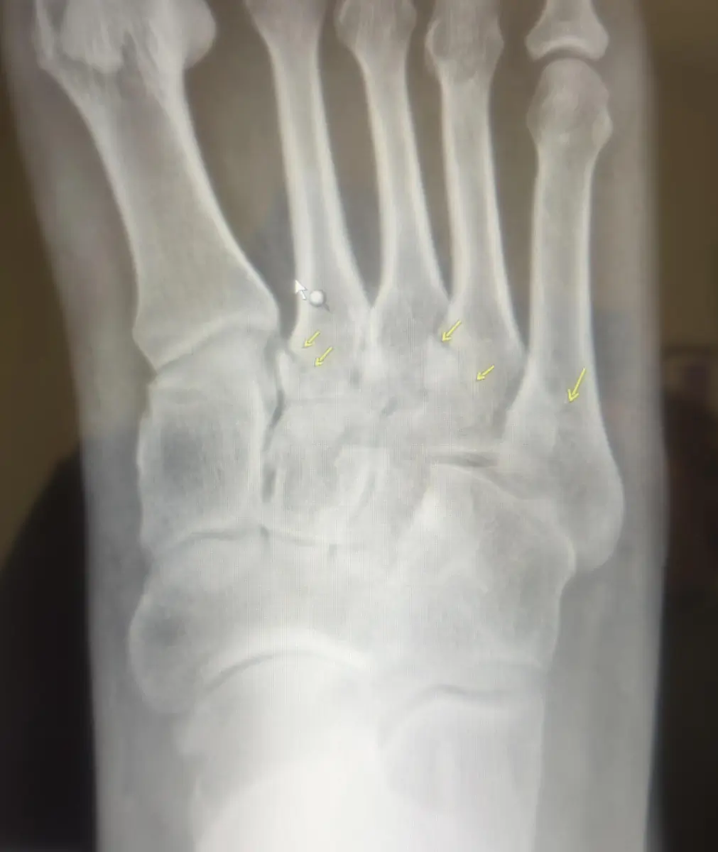 33 years into my life I broke 3 bones at once as well as the only rule my dad ev...